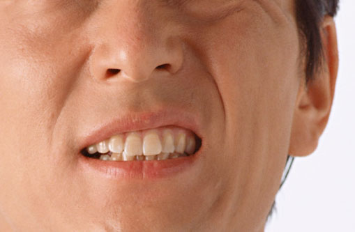 歯の痛みイメージ